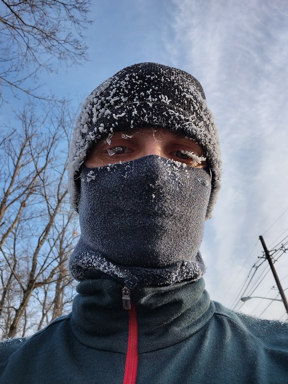 Running is healthy.
